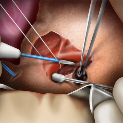 医学・シェーマ CG/イラストレーション制作事例:医学・シェーマ