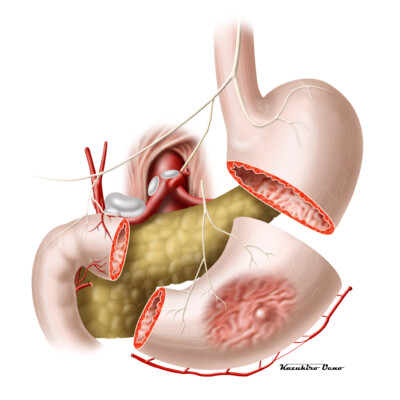 医学・シェーマ CG/イラストレーション制作事例:医学・シェーマ
