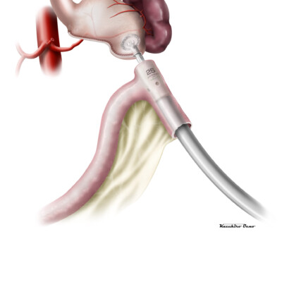 医学・シェーマ CG/イラストレーション制作事例:医学・シェーマ