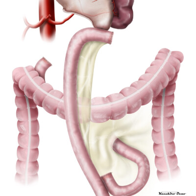 医学・シェーマ CG/イラストレーション制作事例:医学・シェーマ