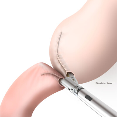 医学・シェーマ CG/イラストレーション制作事例:医学・シェーマ